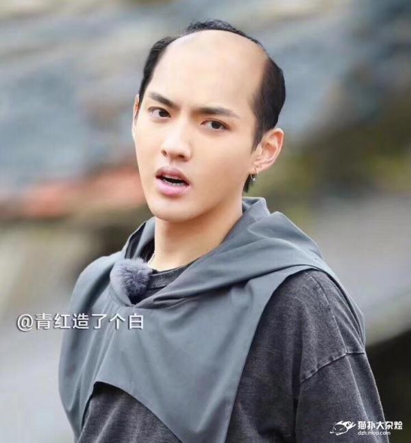 【悲報】イケメンが禿げた結果ｗｗｗｗｗｗｗｗ