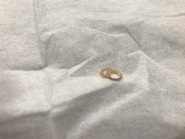 【悲報】ワイ、タラのホイル焼きを作るもアニサキスを見つけ食欲減退ｗｗｗｗｗ