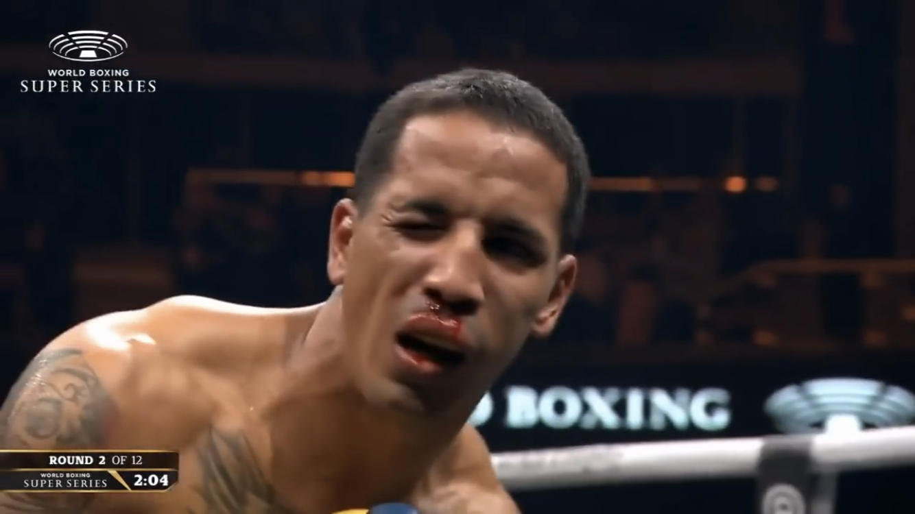 【画像】井上尚弥さん、強過ぎてつまらないｗｗｗｗｗｗｗ