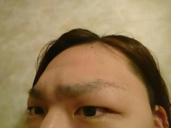 【画像】高校生やけどガチでハゲてきたわｗｗｗｗｗｗ