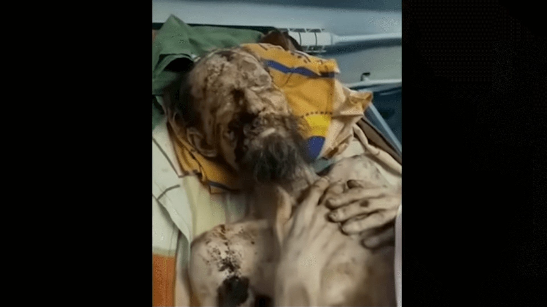 【朗報】野生の熊に1ヶ月監禁された男がミイラ状態になるもなんとか生還するｗｗｗｗ