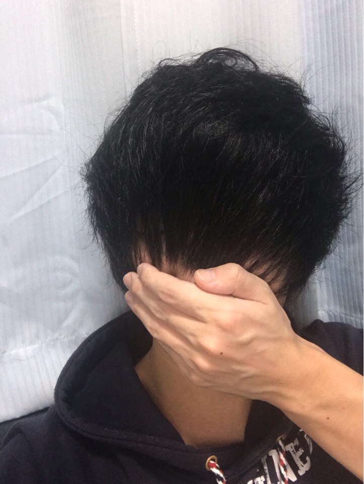 【画像】髪を2ヶ月切らなかった結果とんでもないことにｗｗｗｗ