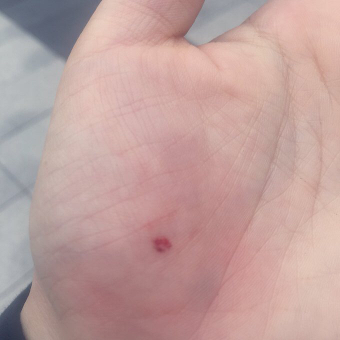 【画像】まんさん「駅でリーマンが傘横持ちして先端が子供の顔に当たりそうになり咄嗟に手で止めた。」