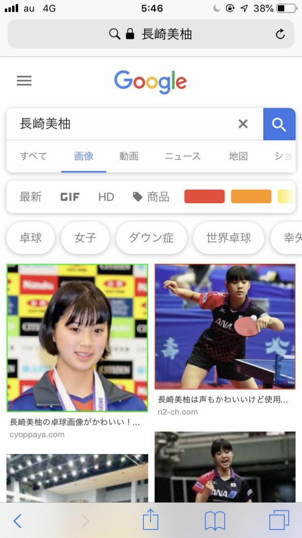 【悲報】卓球の長崎美柚、外見だけでダウン症認定されてしまうｗｗｗｗｗｗｗｗｗ