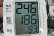 【画像】やばすぎる血圧の人間が見つかるｗｗｗｗｗｗｗ